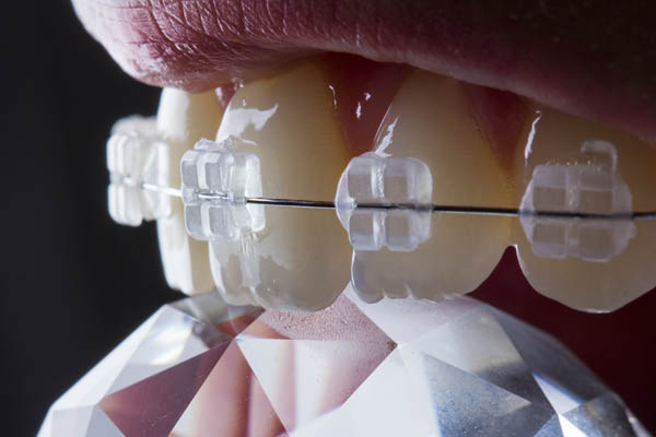 ortodonti tedavisi izmir